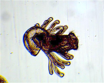 Plancton : Larve Actinotrocha