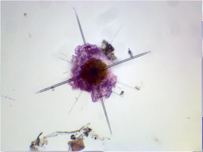 Plancton : Acanthaire